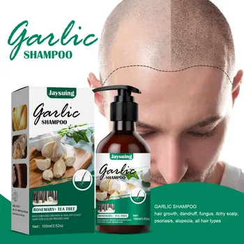 Shampoo Relieve Itching Dandruff Garlic шампоан за коса Growth Prevent Hair Loss Keratin Shampoo and Conditioner шампоан